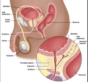 prostatitis egy ember okaiban mint egy spin fáj a prosztatitis